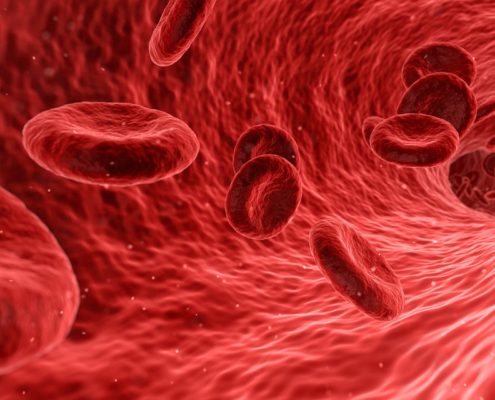Platelet Rich Plasma