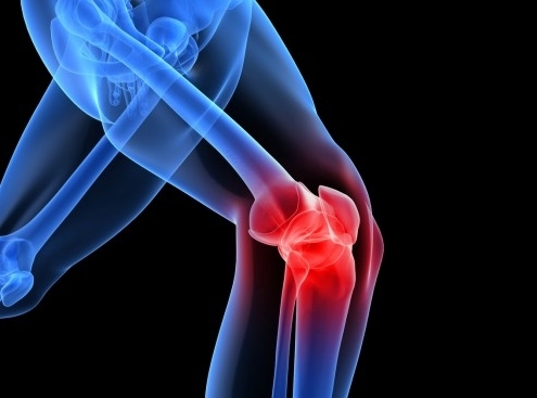 Our Approach to knee injections